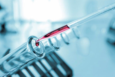 腕に注射して50mlほどの血液を採取します。