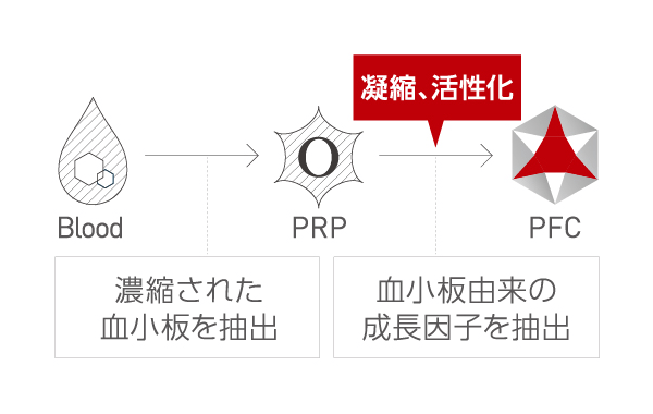 Blood 濃縮された血小板を抽出 PRP 血小板由来の成長因子を抽出 PFC